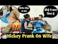 Hickey Prank On Wife|Prank On Wife|Love Bite Prank On Wife|Prank On Wife In India|Hickey Prank India