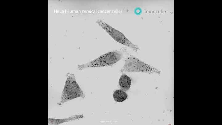 Mitosis and human cervical cancer cells​ (HeLa)