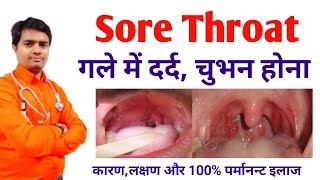 Sore Throat गले में दर्द,गला खराब, बलग़म बनना कारण लक्षण इलाज | Sore Throat Problems