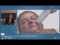 Demonstration of onyx rf microneedling by dr patrick treacy