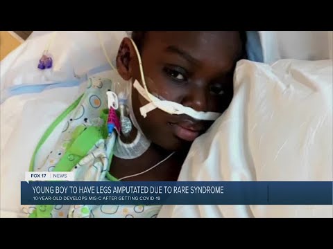 10-year-old boy will have legs amputated due to rare COVID syndrome