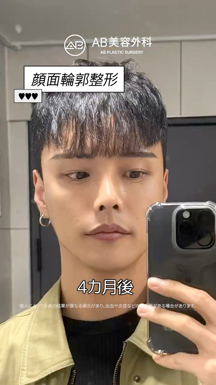輪郭３点で過去最高のビジュアルに🔥 #Shorts