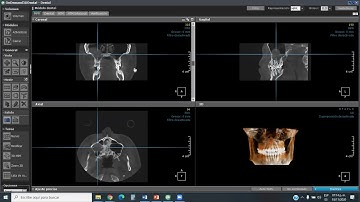 OnDemand 3D Manejo de software de Tomografía Cone Beam. Dr. Enrique Sierra Rosales