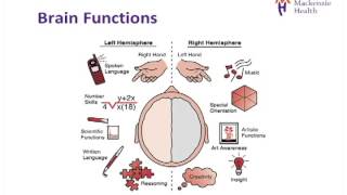 Stroke Education - Causes and Effects