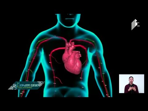 ვიდეო: იპოვეს თუ არა გულის კუნთი?