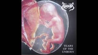 Download Lagu Apoplexy (Slovakia) - Tears of the Unborn (Full Album 1995) MP3 Download Lagu Apoplexy (Slovakia) - Tears of the Unborn (Full Album 1995) MP3