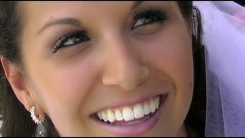 07 - Blemish Removal