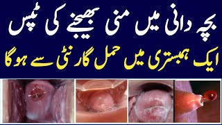 How To Send Semon In Uterus | Part Two | How To Done Semon and eggs in uterus Resimi