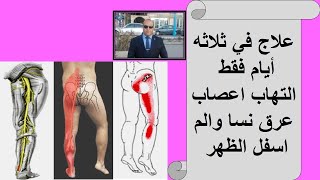 علاج في ثلاثه أيام فقط I التهاب اعصاب عرق نسا والم اسفل الظهر