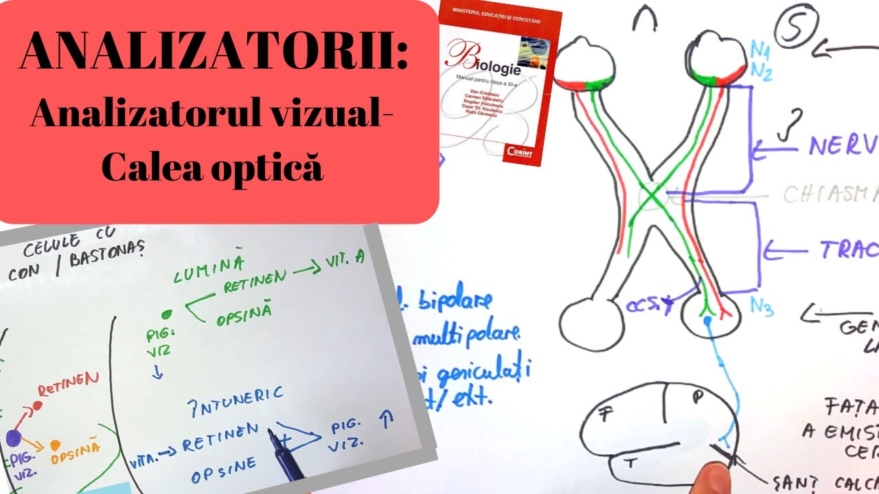 cauze vizuale achromatice este posibilă vindecarea vederii minus 10