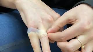 Download Lagu Jari Palsu - CV. INDO ORTHOPRO MP3