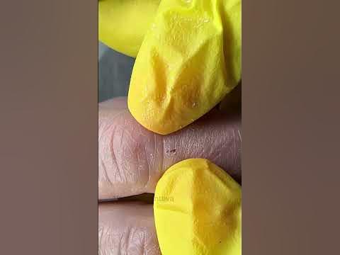 Заноза на пальце что делать? Как убрать занозу на пальце руки? #nails # ...