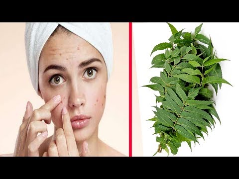 ব্রন-ও-ব্রনের-দাগ-দূর-করার-সহজ-ও-কার্যকরী-উপায়-||-how-to-remove-pimples-easily-at-home-||-by-hla