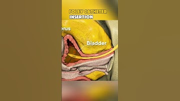 Foley catheter insertion #medicalstudent #3danimation #healthcare #medical3danimation