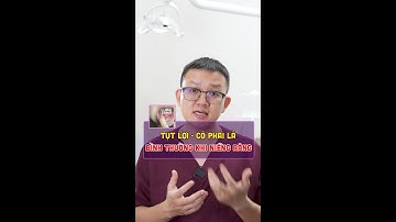 Tụt lợi - có phải một hiện tượng bình thường khi niềng răng