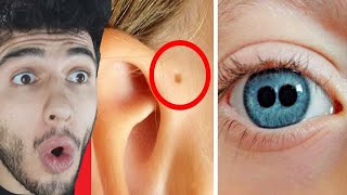 Çok Az Ki̇şi̇de Bulunan En Nadi̇r Fi̇zi̇ksel Özelli̇kler