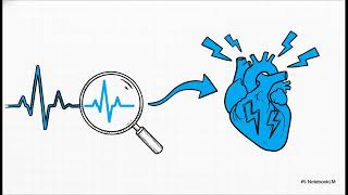 3.11.1 FORMAS DE ONDA DEL ELECTROCARDIOGRAMA NORMAL