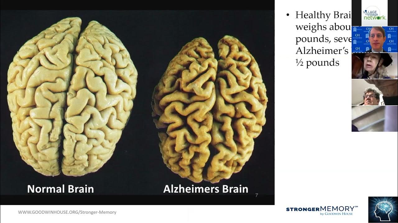 Brain vs brain