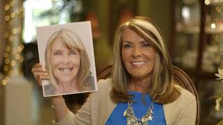 New Teeth Now – New Zygomatic Implants – Giving Patients A New Smile