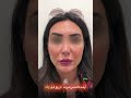 جهت دریافت مشاوره رایگان با شماره ۰۹۱۲۱۵۹۲۲۲۲ تماس حاصل نمایید