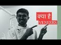 Dental Veneers Kya Hota Hai (2019) | The Dental Home TV