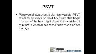 Pance Exam Cramslide - Psvt