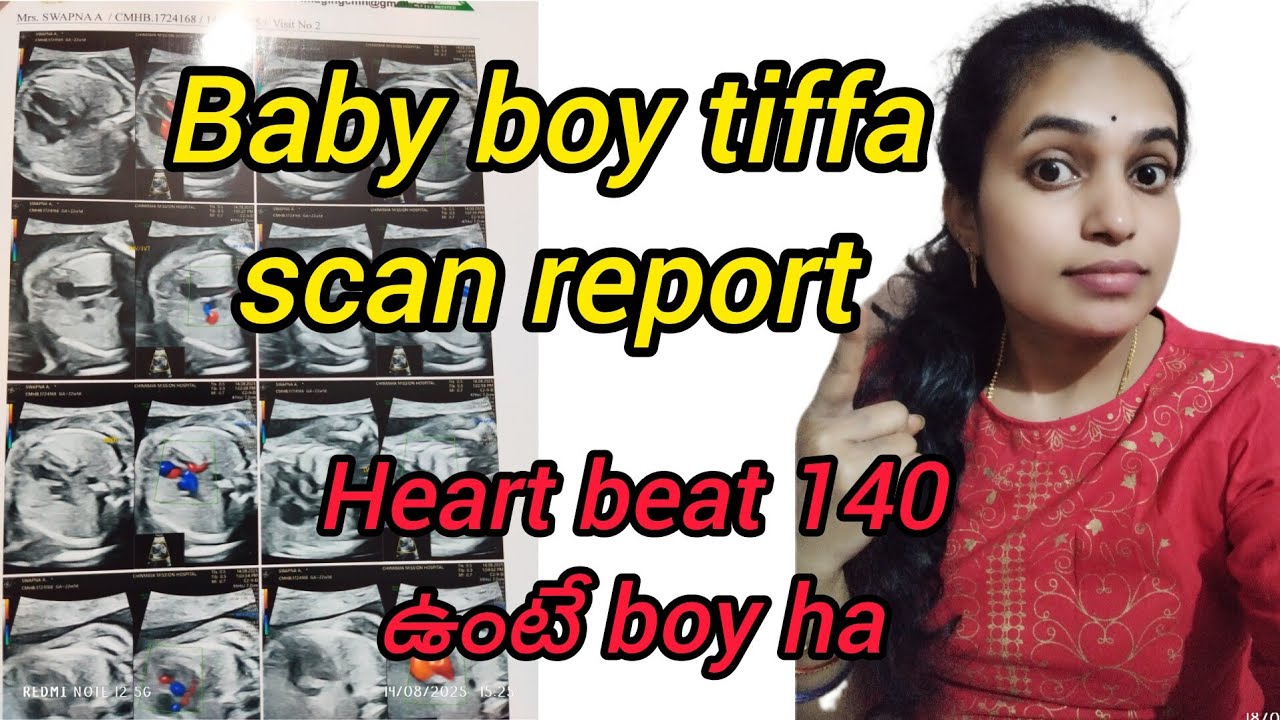 || Baby boy tiffa scan report  || బాబు   tiffa scanning report ||