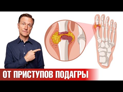 Средство №1 от приступов подагры, которое есть у каждого👍