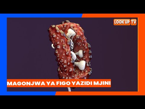 Video: Je, waajiri wa CA wanaweza kuhitaji barua ya daktari kwa likizo ya ugonjwa inayolipishwa?