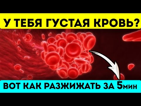 Разжижает даже самую густую кровь быстро! Для сосудов, сердца, мозга...