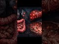 Advanced Colon Cancer Treatment | Stage 4 Bowel Cancer Treatment in Germany