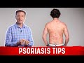 How to Get Rid of Psoriasis? – Natural Remedies for Psoriasis by Dr.Berg