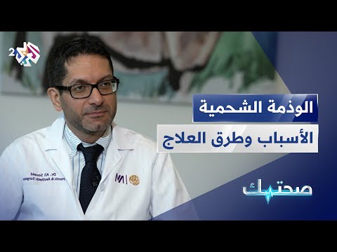 الوذمة الشحمية أو تراكم الدهون الأسباب والأعراض والتشخيص والعلاج دليلك الشامل