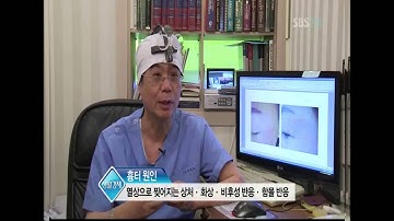 SBS 생활경제 진세훈 성형외과 자가진피재생술