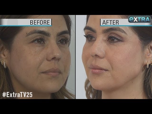How to Get a Quick Face-Lift Without Surgery