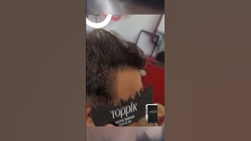 Thumbnail of Thin Hair NO MORE! Toppik Hairline Optimizer Transformation Before & After!  #hairbuildingfibres