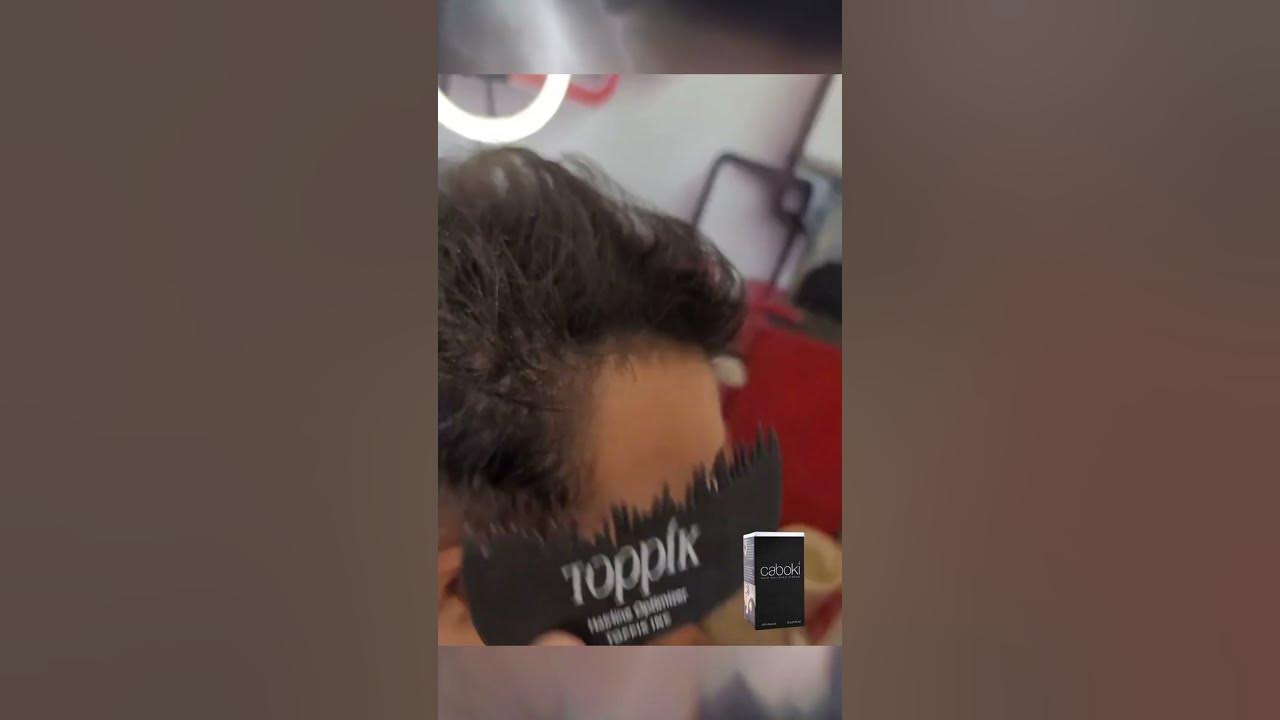 Thin Hair NO MORE! Toppik Hairline Optimizer Transformation Before & After!  #hairbuildingfibres