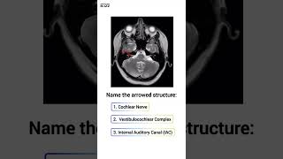 👂 Anatomy Quiz:👂 #anatomy #radiologybuzz #medicalquiz