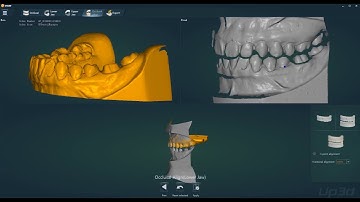 how to scan big articulator with UP300+