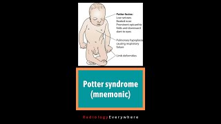 Potter syndrome | mnemonic- POTTER | Radiology tutorials | B/L renal agenesis | video 48