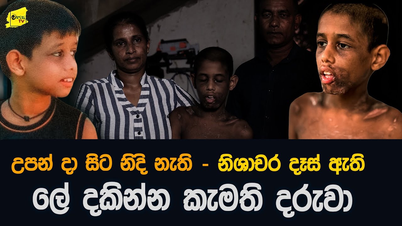 අවුරුදු 14ක් නිදාගෙන නැති රෑටත් ඇස් පේන අමුතු හැසිරීම් ඇති කවීෂගේ කතාව @wanesatv