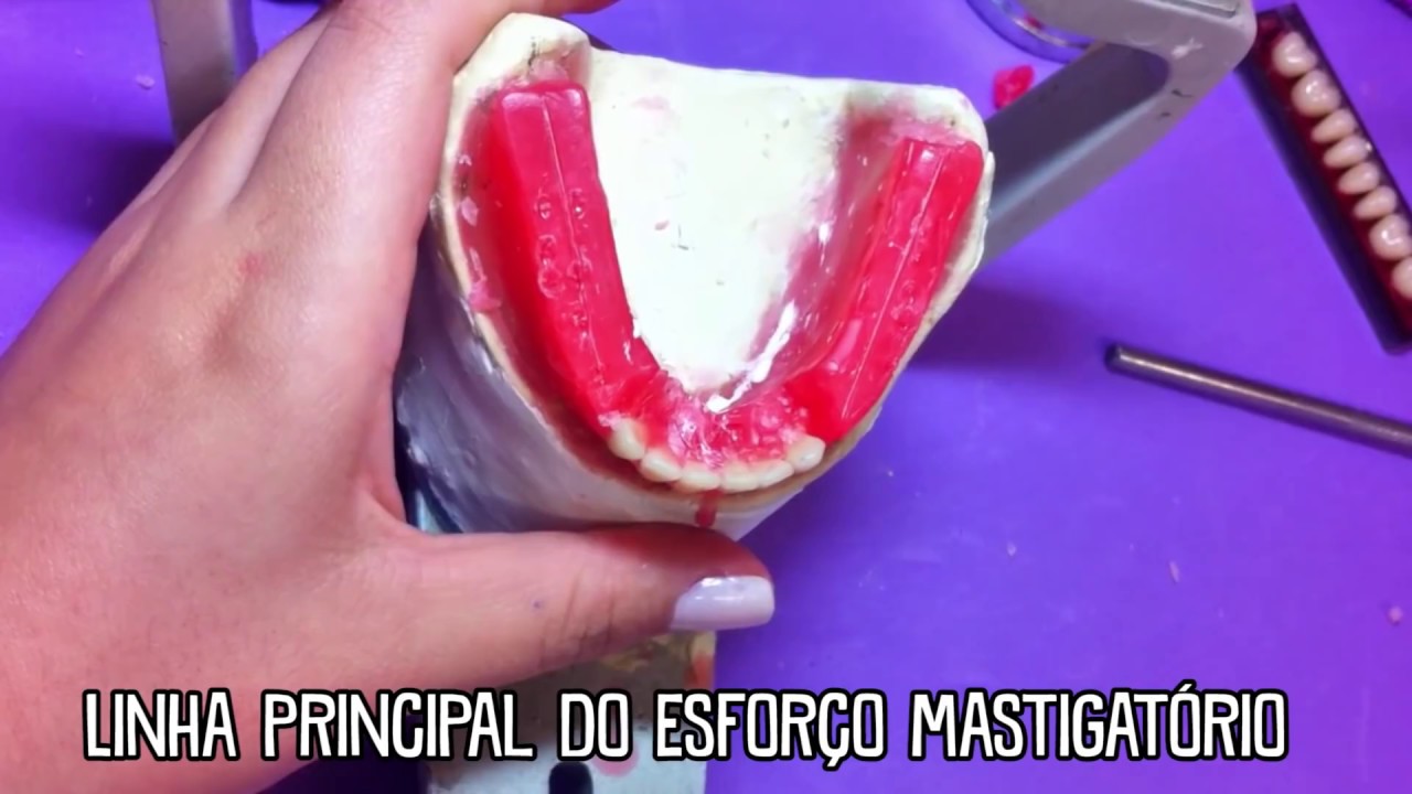 Montagem de Dentes em Prótese Total