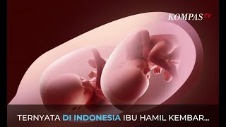 Fenomena Sindrom Langka Pada Bayi Kembar, Ini Penjelasan Dokter