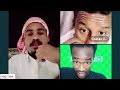 Jaal Ibsaa Fi Caalaa Nure Dabbal Itti Buharaa March 20 2025 Jaal Ibsaa Fi Caalaa Nure Dabbal Itti Buharaa March 20 2025