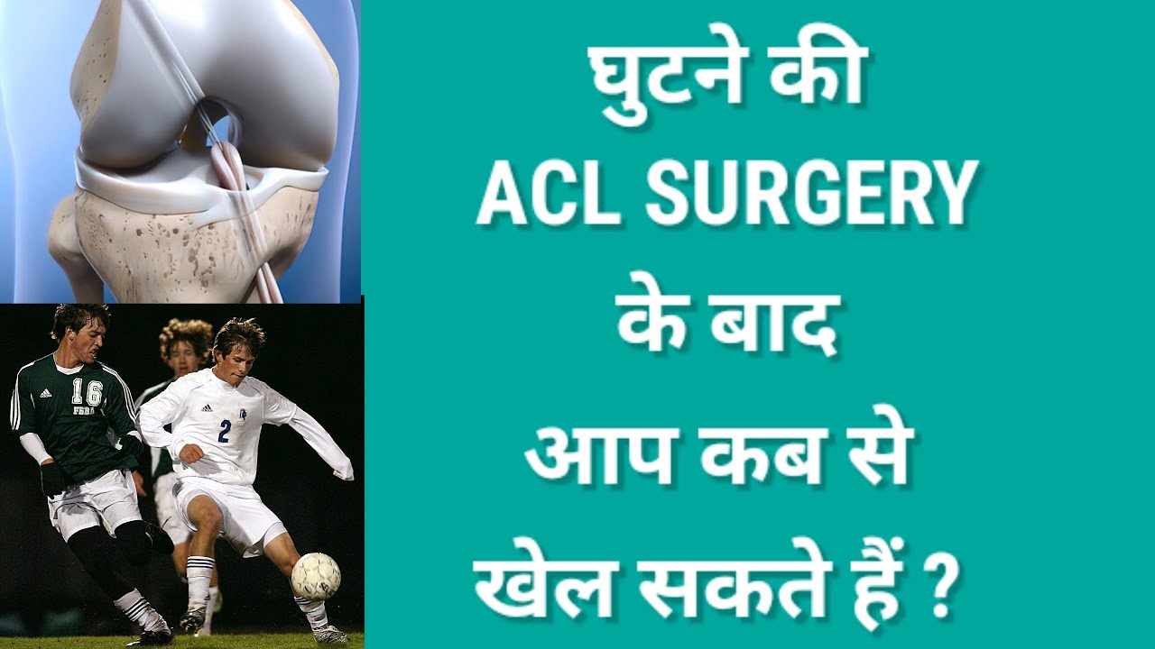 ACL सर्जरी के बाद आप कब से खेल सकते हैं ? WHEN CAN YOU PLAY AFTER ACL SURGERY ? ACLRECOVERY 