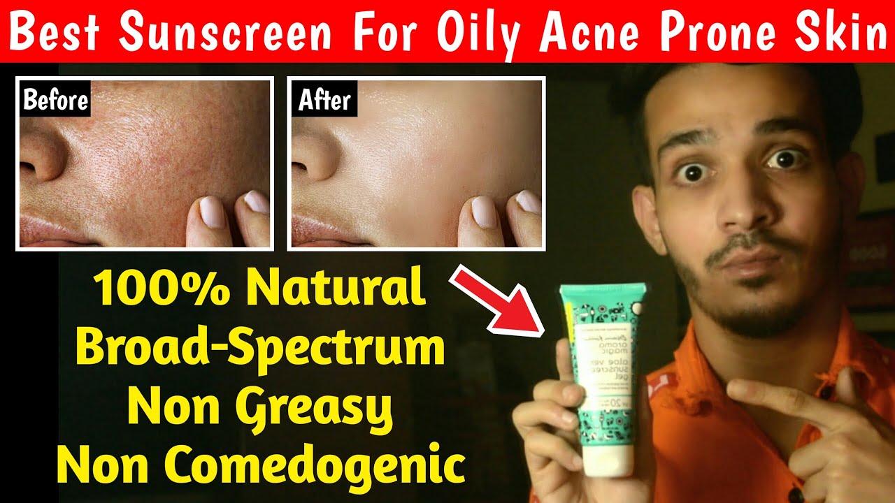 Oily Acne Prone Sensitive Skin के लिए सबसे अच्छा Sunscreen Aroma