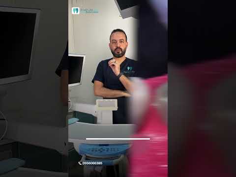 أزرع ولا أركب أسنان يا دكتور