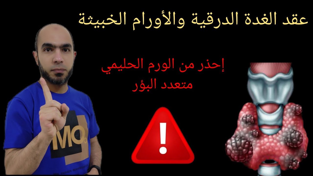 إحذر من الورم الحليمي متعدد البؤر/ إجراء جراحي لابد منه /عقد الغدة والأورام الخبيثة @Dr_youssef