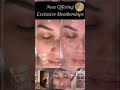 Unlock Radiant Skin with IceFit Studio MedSpa – Essential & Elite Memberships