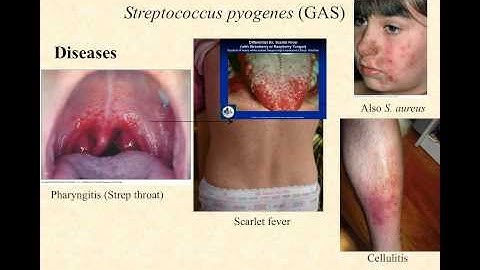 bio220 video lecture streptococci part II